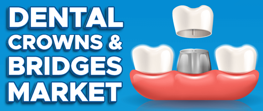 Dental Crowns and Bridges Market