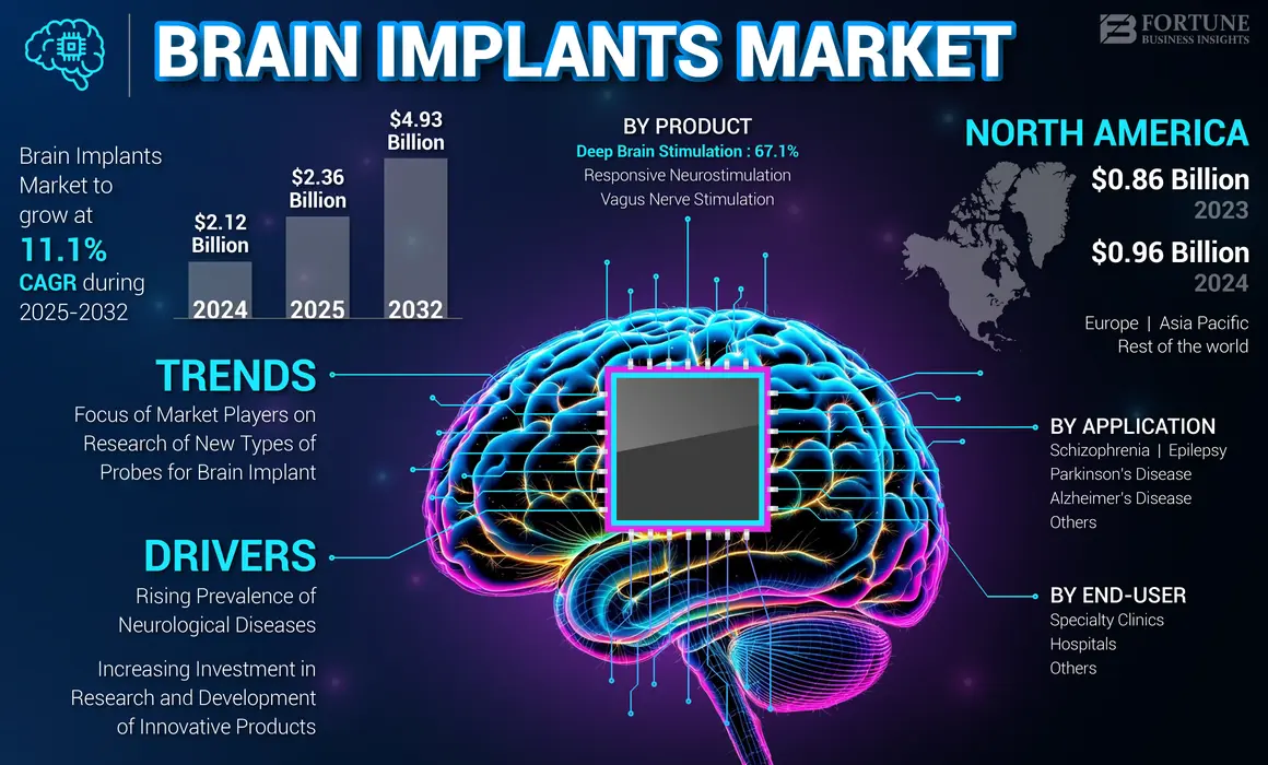 Brain Implants Market