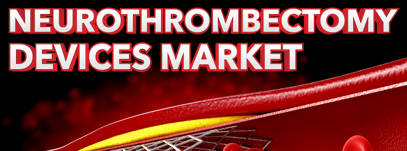 Markt für Neurothrombektomie Geräte