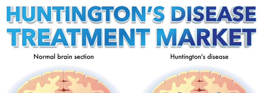 Huntington's Disease Treatment Market