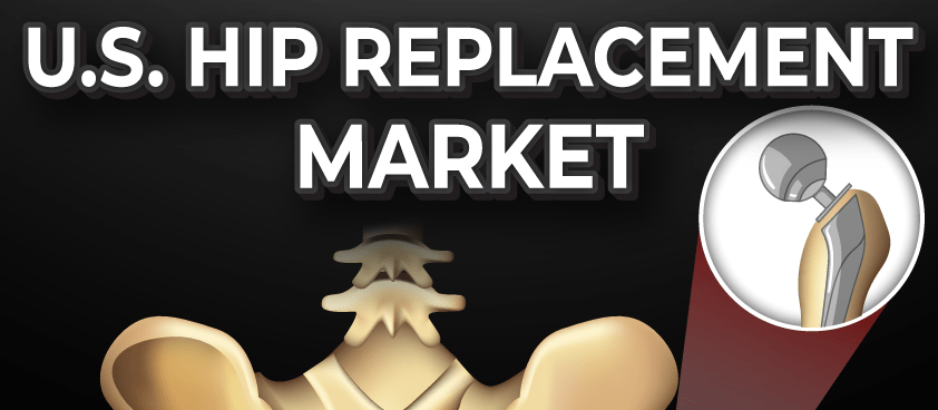 U.S. Hip Replacement Market