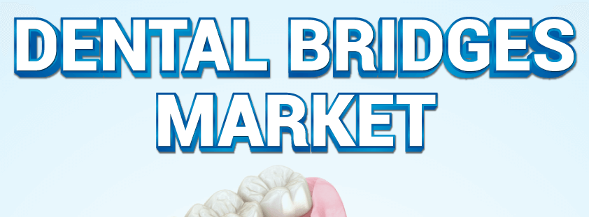 Dental Bridges Market